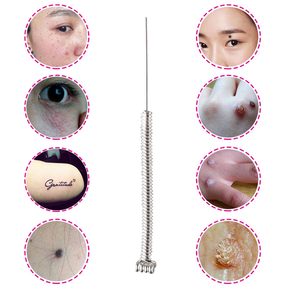 100&200Pcs Plasma Pen Needle f - Embroidery Removal recension och pris